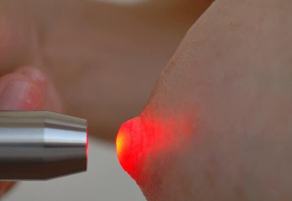 Lasertherapie