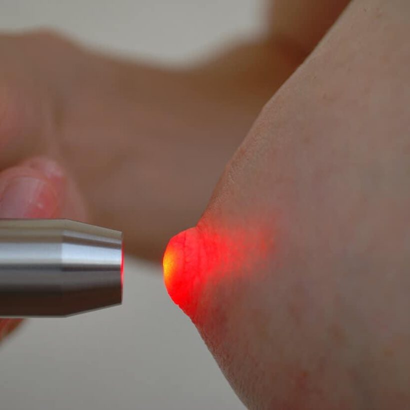 Lasertherapie